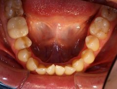 Результаты лечения: Пациентка И. - фотография до лечения