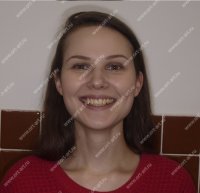 Результаты лечения: Пациентка С. - фотография до лечения